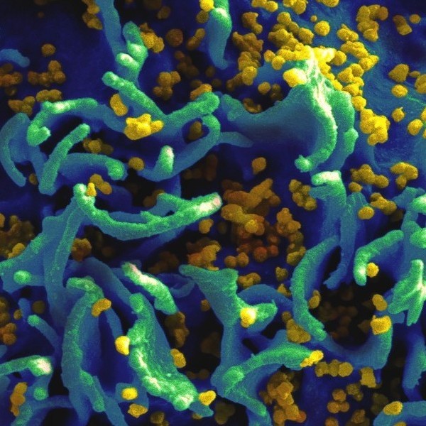 ВИЧ,иммунная система,ДНК,вирус, Ученые узнали, как именно ВИЧ убивает иммунные клетки